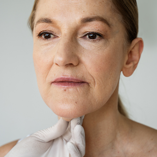 Hormonal Changes Image